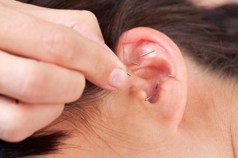 Traditional Chinese Medicine: Utilizing the Healing Properties of Nature